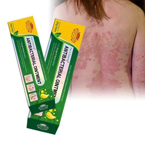 Wholesale Custom Herbal Skin Ringworm Cream Skin Eczema Itching Acne Fungal Infection Ointment 
