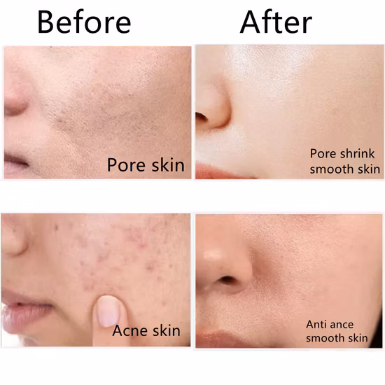 on Sale Nectar with Remove Freckle Cleanser Cream Whiten Cleanser Face Wash